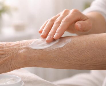 découvrez comment appliquer la meilleure crème pour dermatoporose afin d'obtenir un effet optimal et revitaliser votre peau efficacement.